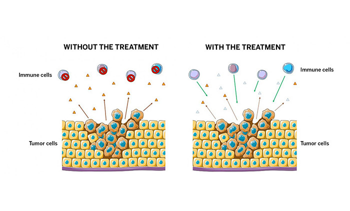 New Cancer Treatment Uses Enzymes to Boost Immune System and Fight Back