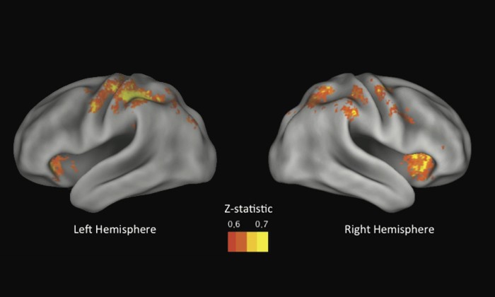 Brain Scans Show We Take Risks Because We Can't Stop Ourselves