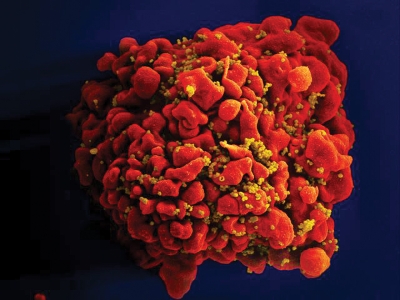 b2ap3_thumbnail_cell_hiv.jpeg