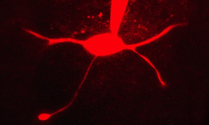 Serotonin Regulates the Sensitivity of Brain Cells Involved in Hearing